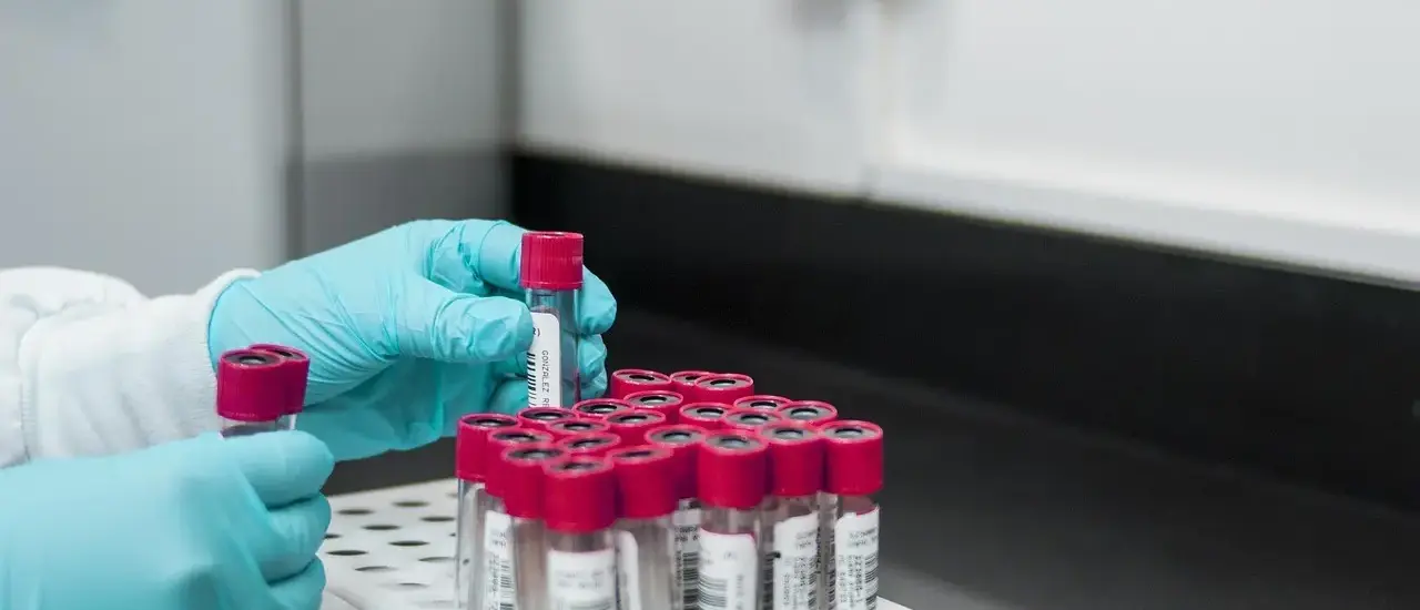 Hvilken blodtype har jeg? Opdag blodets hemmeligheder - fra kostråd til sygdomsrisiko